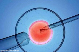 高龄二胎成功案例